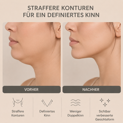 VisoLift™ – Für eine definierte & straffere Kinnlinie