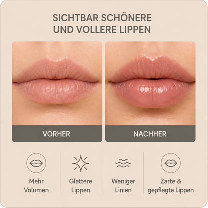 LumiLips™ - LED Lippen Booster